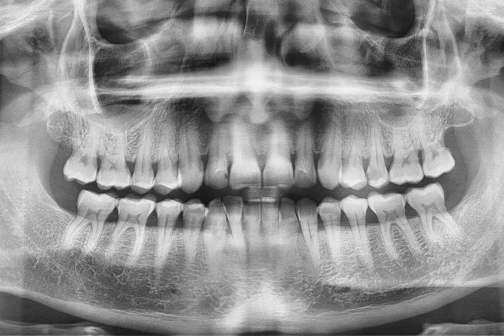 Kuukausimaksulla halpaa hammashoitoa?