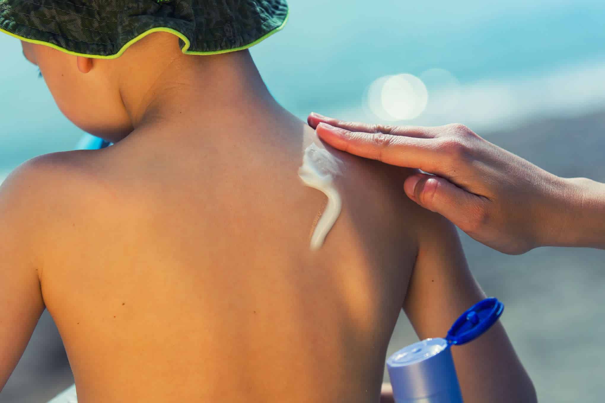 Aurinkorasvaa levitetään lapsen selkään.