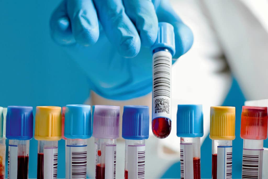 Mistä lääkärin määräämän laboratoriotestin saa halvimmalla? Selvitimme
